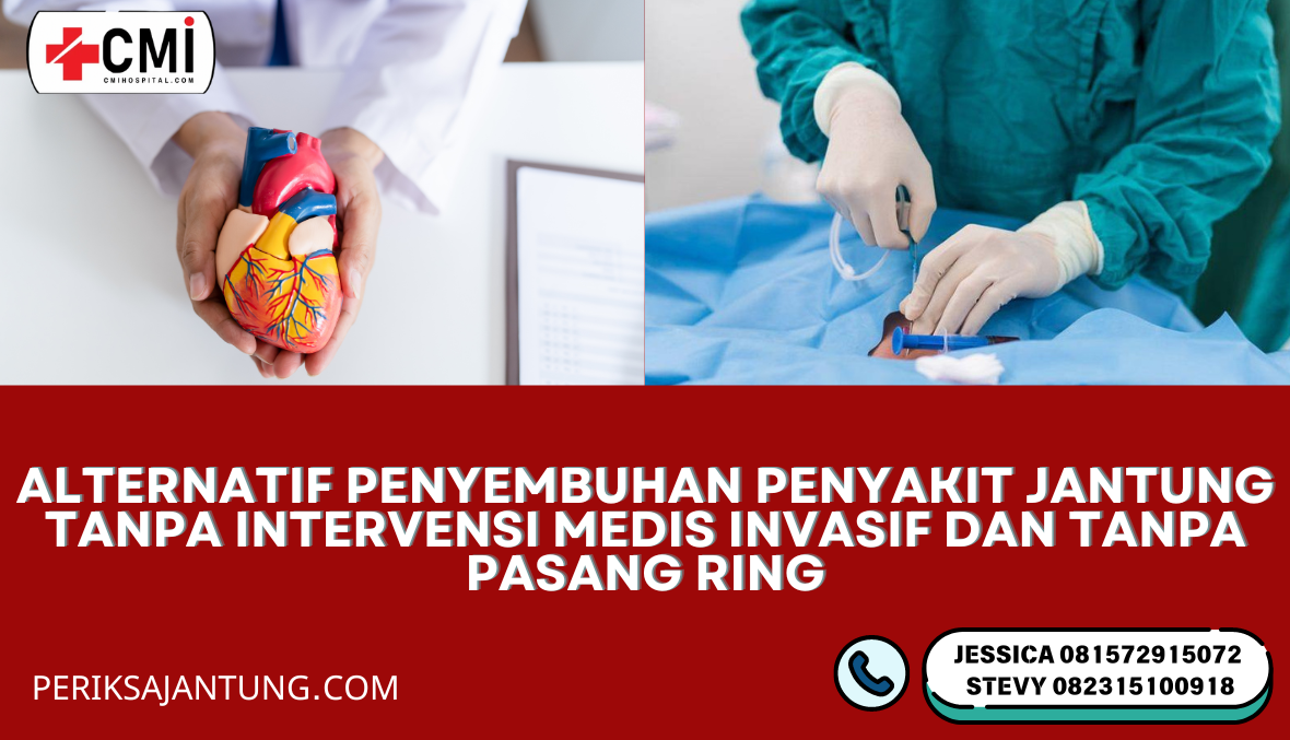 Alternatif Penyembuhan Penyakit Jantung Tanpa Intervensi Medis Invasif dan Tanpa Pasang Ring